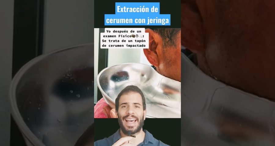 extracción de tapones compactos