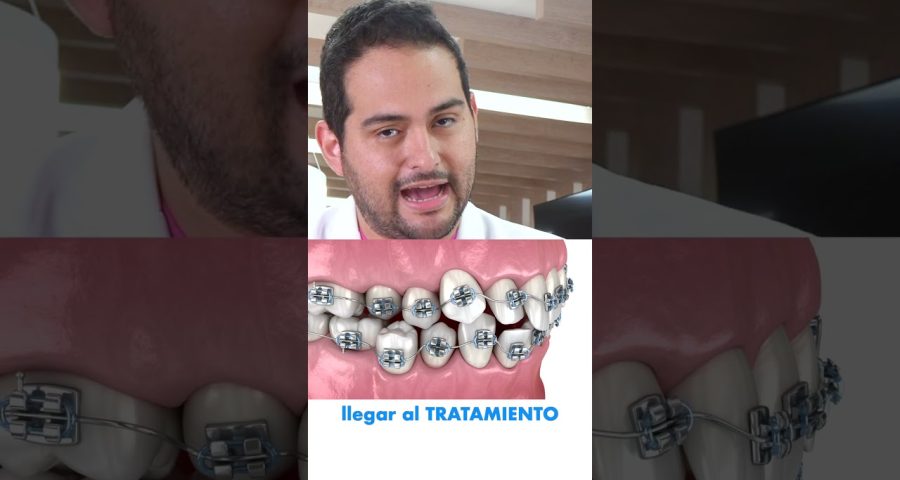revisión de tuberías con crecimiento radicular